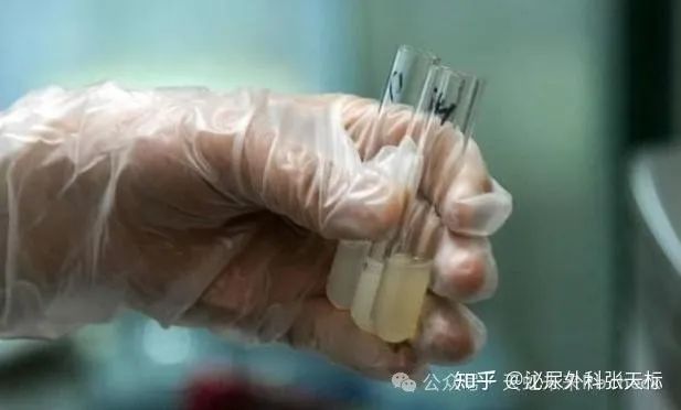 精子银行_捐精子怎么取精子_国内未婚做试管机构