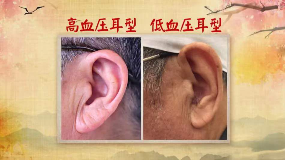 耳鼻喉科_耳_耳