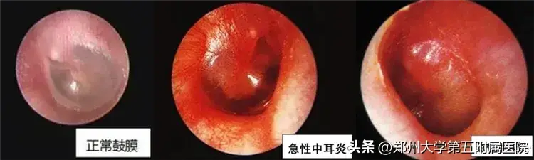 耳鼻喉科_耳_耳