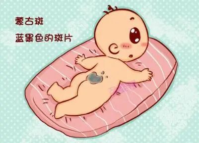 菩萨送胎记带孩子好吗_菩萨送的孩子带胎记_菩萨送胎记带孩子可以吗