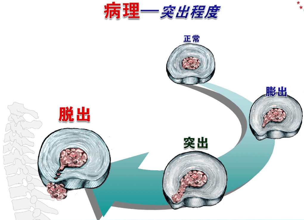 骨道堂_骨道破裂_道骨