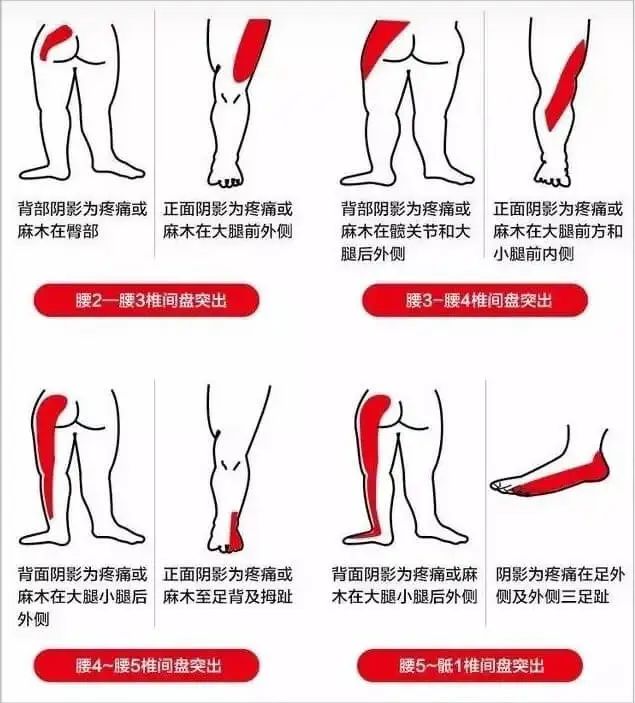 道骨_骨道堂_骨道破裂