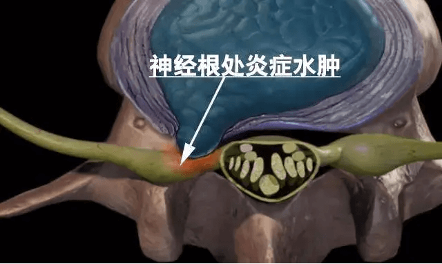 道骨_骨道破裂_骨道堂